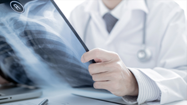 Ein Arzt, der sich eine Röntgenaufnahme ansieht. 